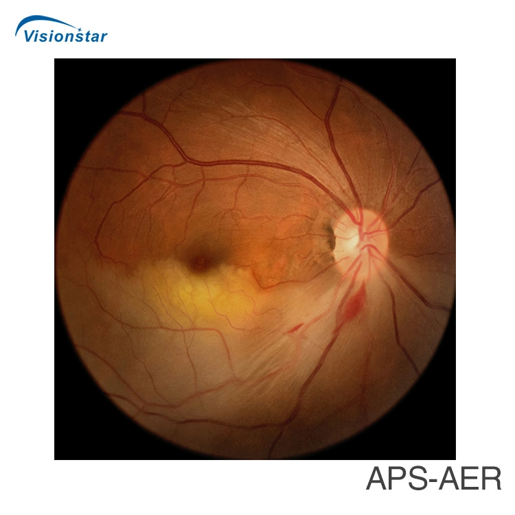 with Ce FDA Approved Fundus Camera