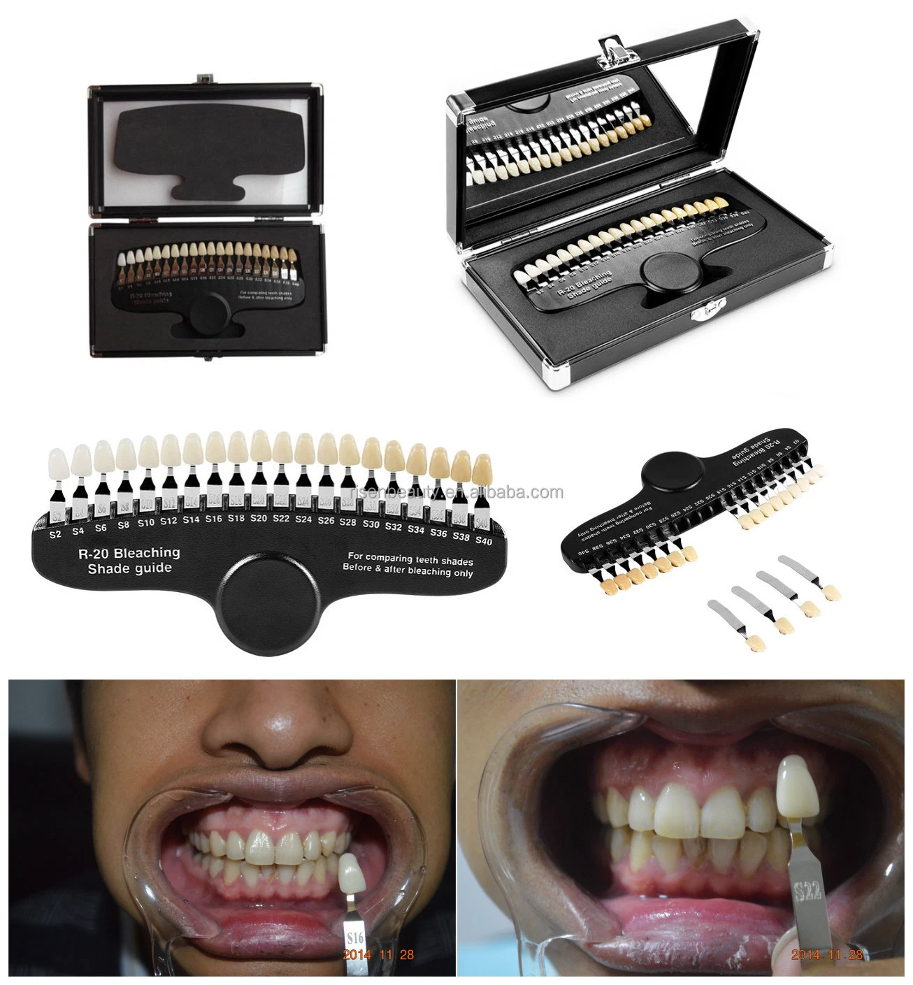 Zahnaufhellung Farbtabelle Zahnaufhellung Farbschattierung Anleitung Dental Shade Guide Zahnfarbkarten