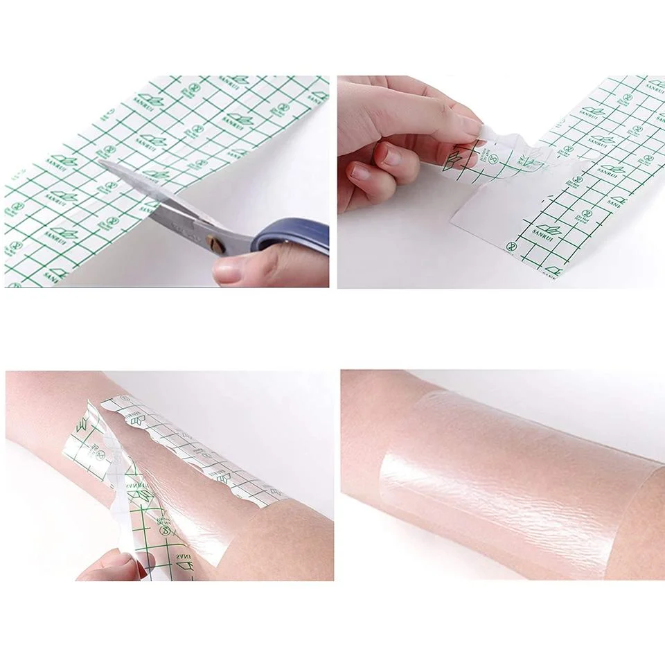 Suministro de fábrica buena calidad médica transparente impermeable PU película adhesiva Material herida quirúrgica