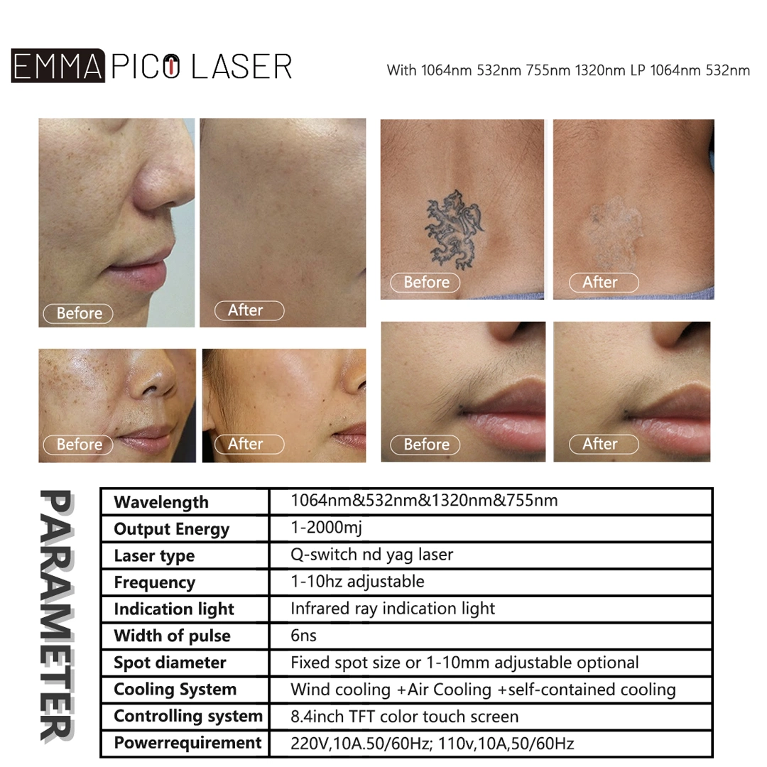 Picosecond 1064 Nm 755nm 532nm Pico Q switched ND YAG Laser Pico tatuagem Laser extracção