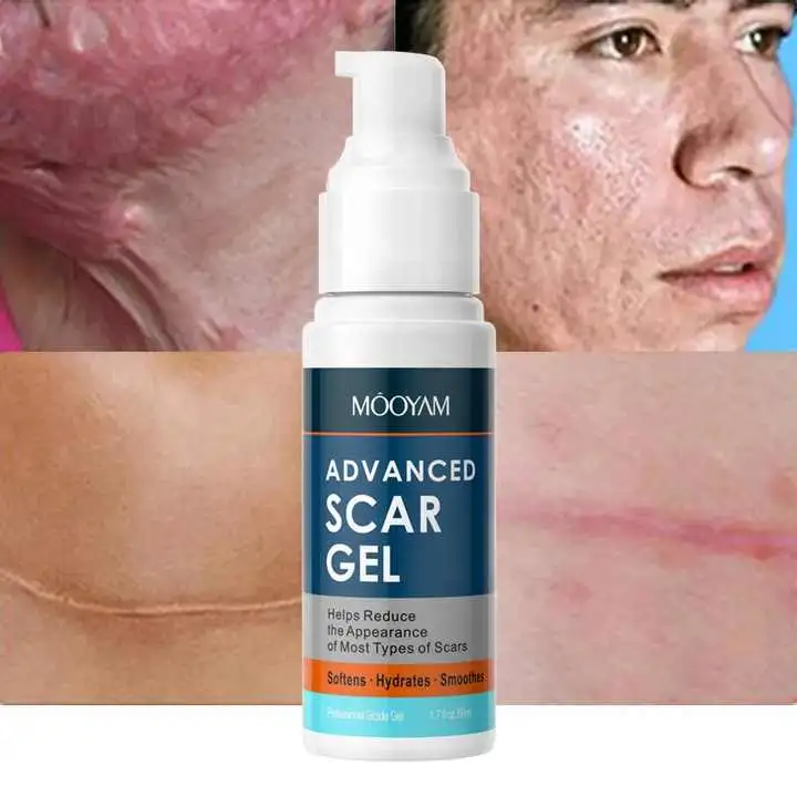 Productos para el cuidado de la piel Acne tratamiento Scar Gel Crema Reparación de cicatrices de la piel Gel de extracción