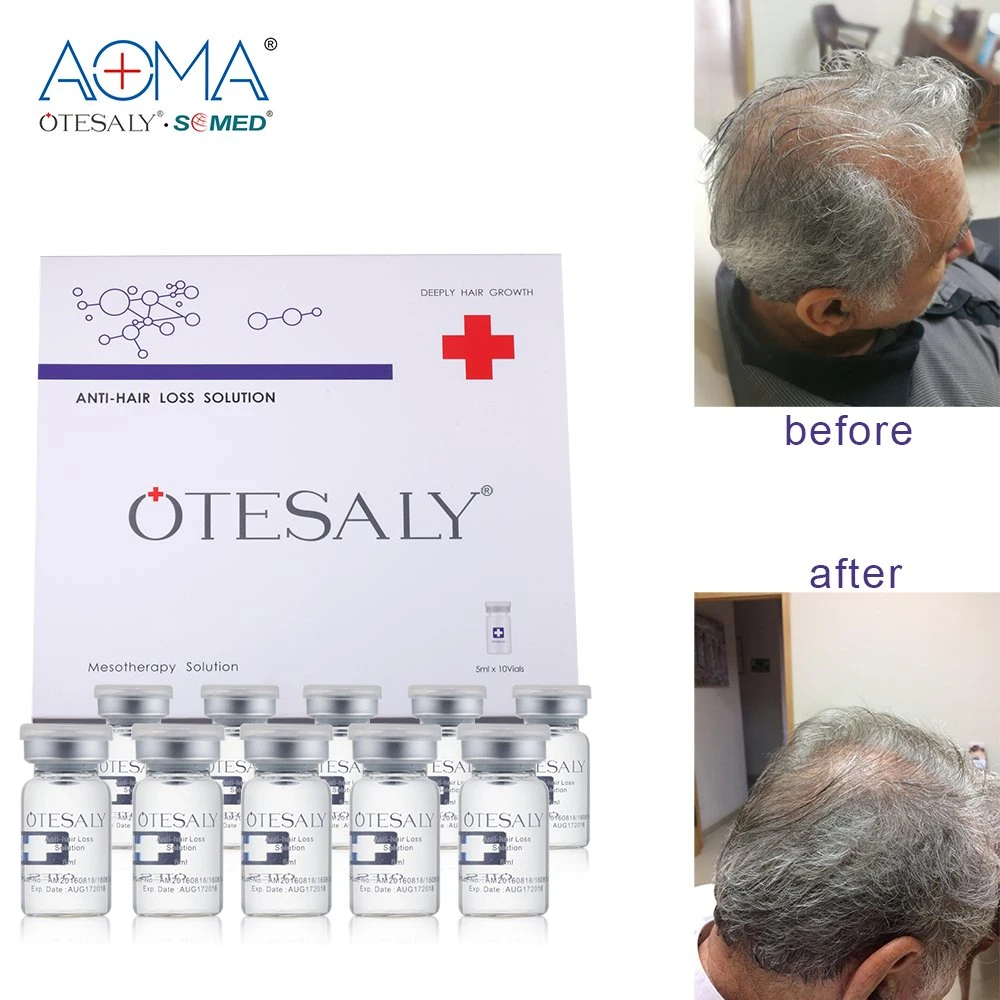 5ml 10 viales cada caja 50ml solución de Meso Anti-Hair Loss Tratamiento de Cabello de crecimiento de alta calidad Precio Otesaly al por mayor Mesoterapia Inyección