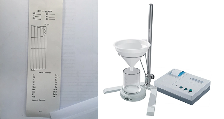 Medidor de fluxo de urina, Equipamento Uroflowmetry Uroflowmeter,