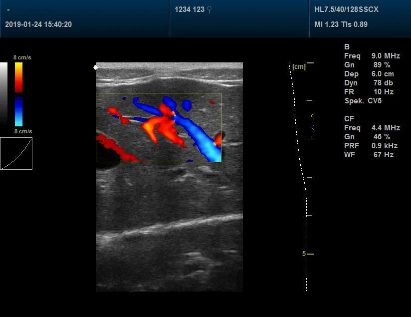 Doppler Vet Ultrasound Scanner High Technology Portable Function Color Vet Scanner