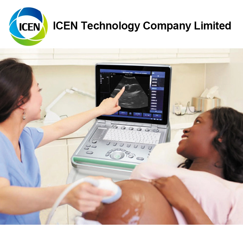 IN-A032-2 ICEN Portable Digital Ultrasound Machine Pregnancy Equipment