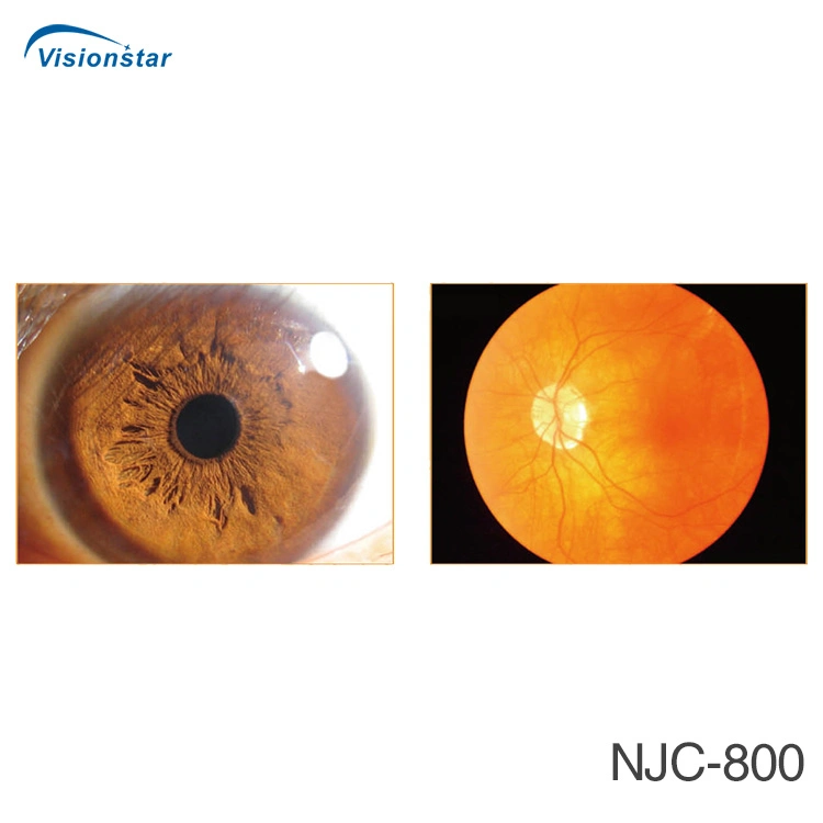 Njc-800 China Venta caliente Equipo oftalmológico Pantoscopic oftalmoscopio.