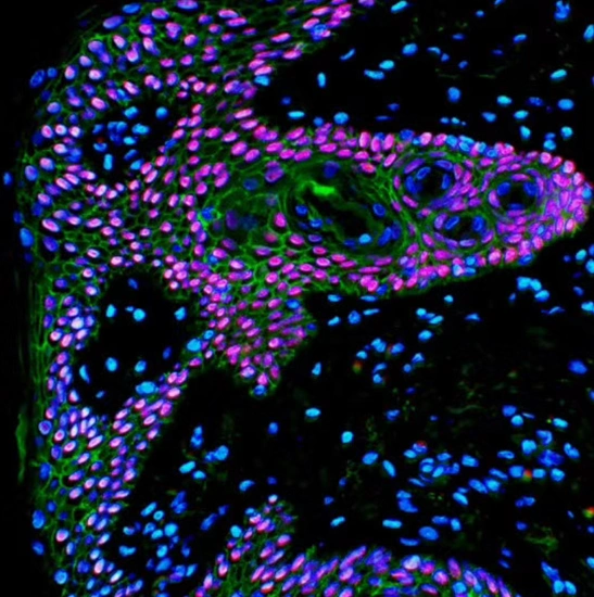 BestScope BS-2081F fluorescente de investigación de alto nivel biológico de laboratorio para microscopio trinocular