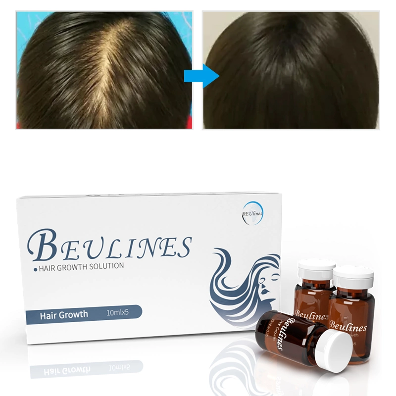 Venda a quente 50ml de essência de crescimento de Tratamento de perda de cabelo óleo de argão crescimento natural do cabelo produtos para cabelo Soroprofilaxia homem mulher