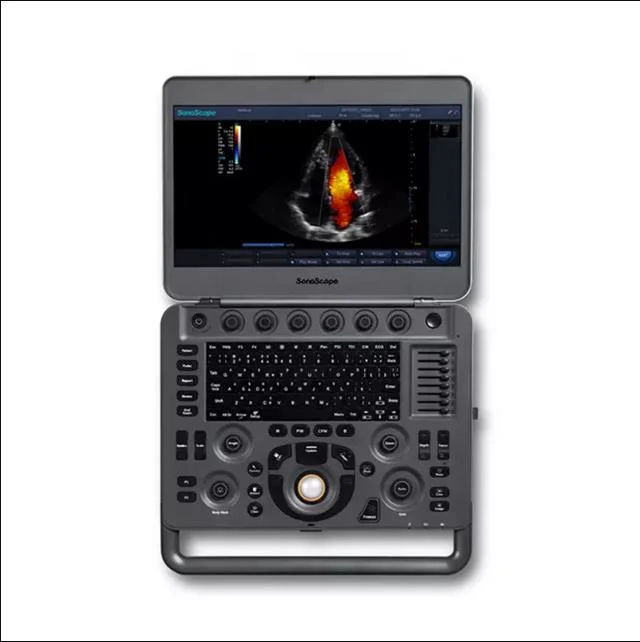 Hospital Laptop Type Sonoscape Advanced X3 High End Portable Cardiac Vascular Thyroid Scan Ultrasound Scanner