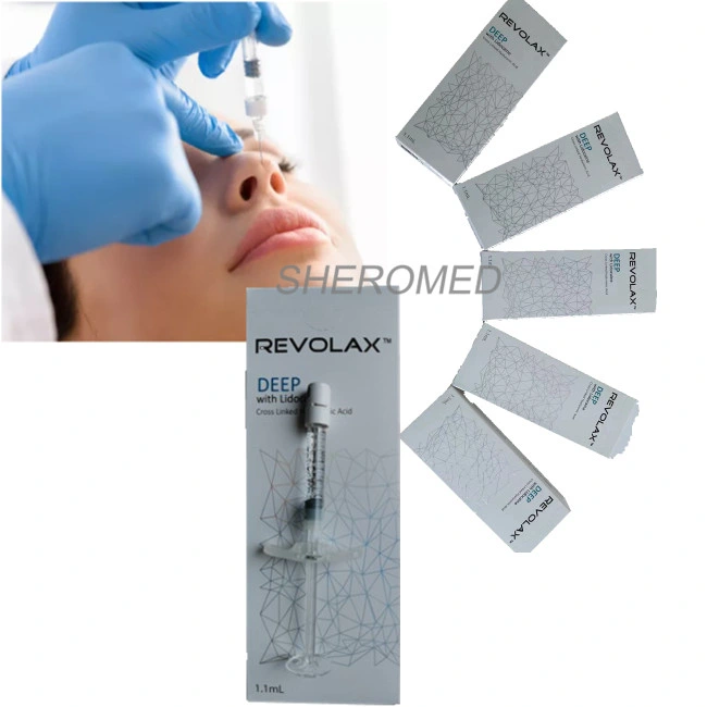 1ml Revolax Sodium Hyaluronate for Nose Augmentation