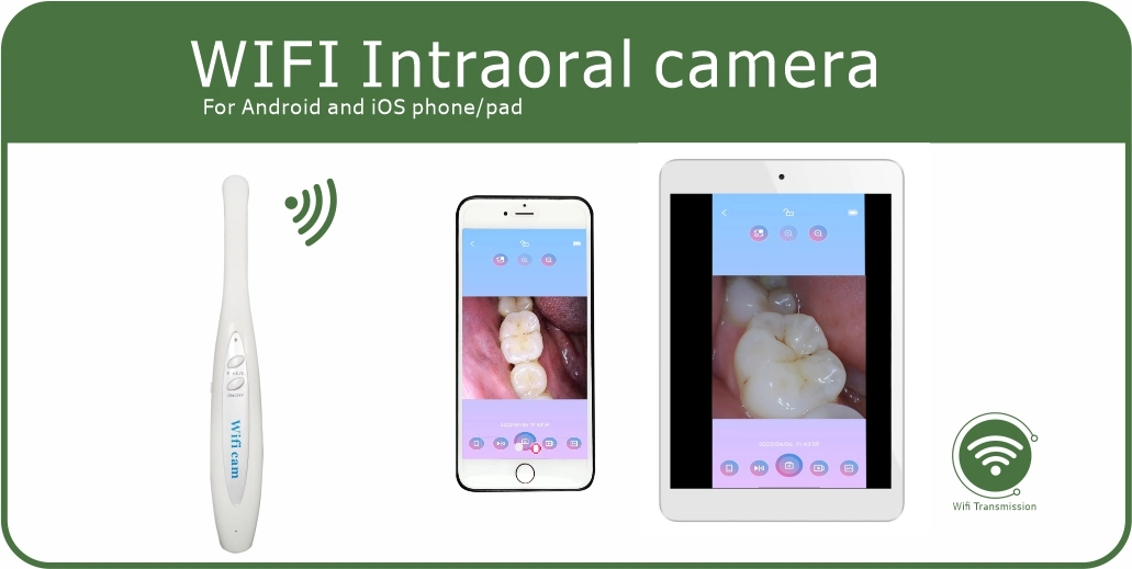 La última venta caliente Wireless WiFi Cámara Intraoral W1000