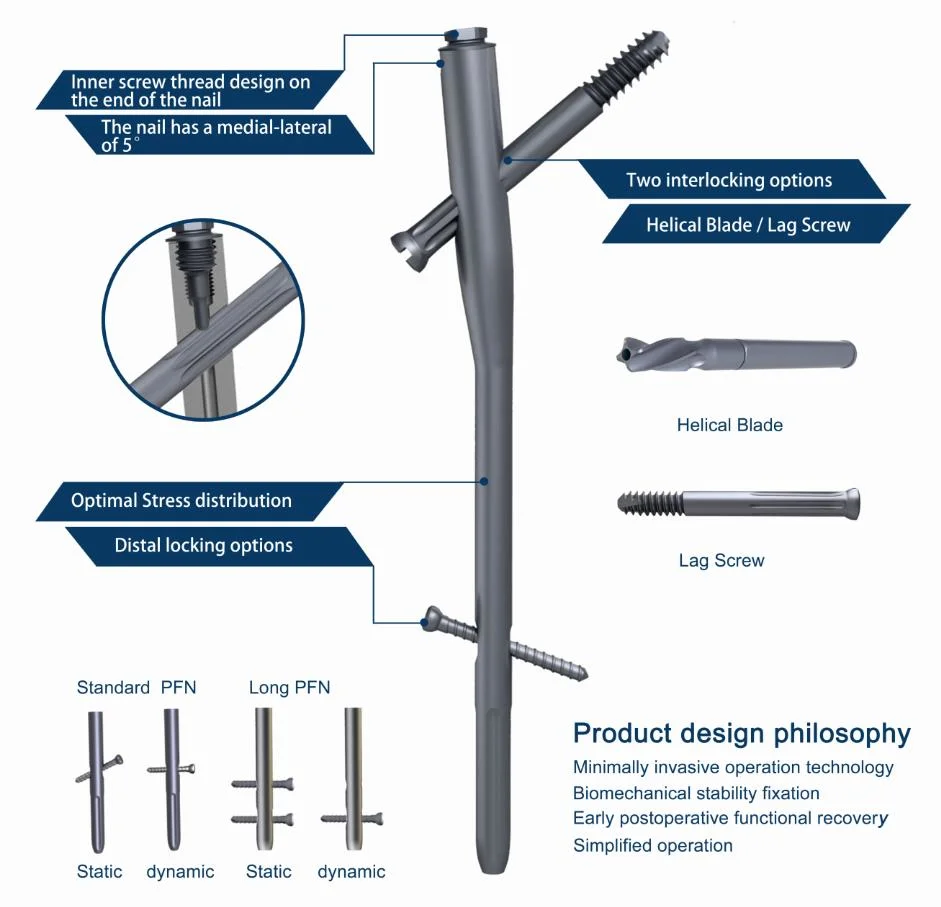 Orthopedic Implants Pfna Intramedullary Nail Femoral Interlocking Nail Gamma Proximal Femoral Femur Implants Factory