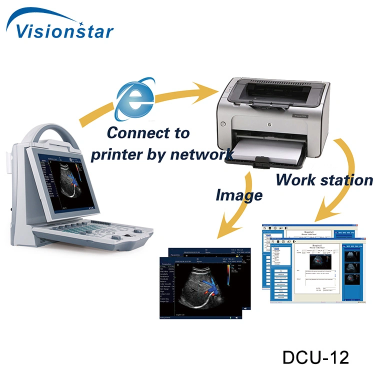 Dcu-12 Color Doppler Ultrasound Scanner (Veterinary)