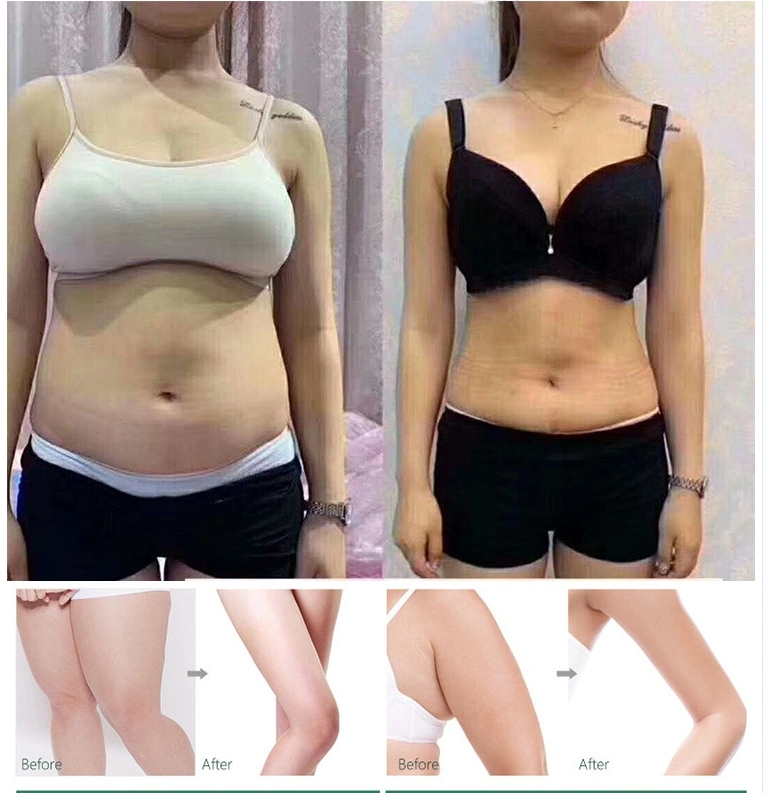 Schlankheits-Produkte Auflösen Körperfett Slimming-Produkte Korea Shape Körper/Schönheit Modellieren Sie Die Rote Ampulle