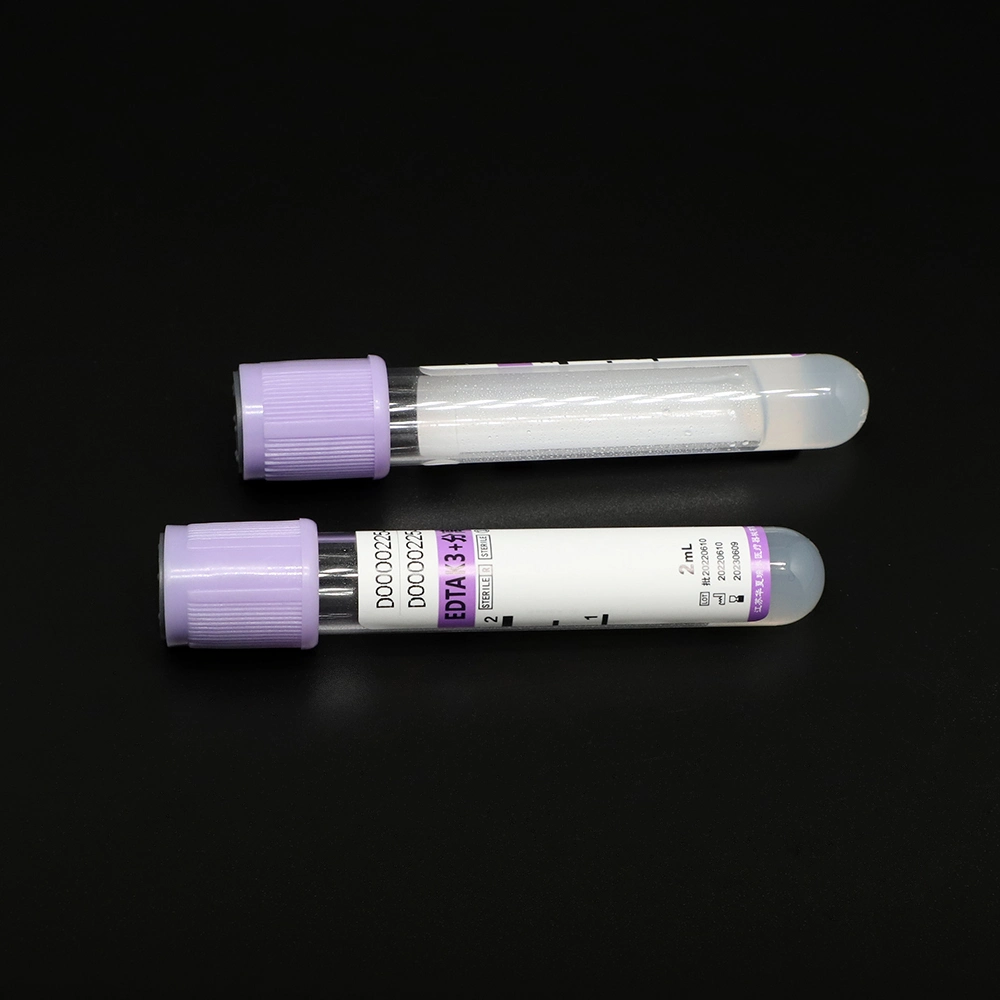 Good Service Laboratory Disposable Glucose Tube 1-10ml Medical Products Non-Vacuum Vacuum Blood Vessel