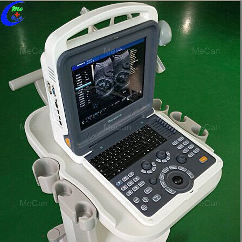 Portable Ecografo 4D Color Doppler Ultrasound Machine, Portable Echo Ultrasound Scanner