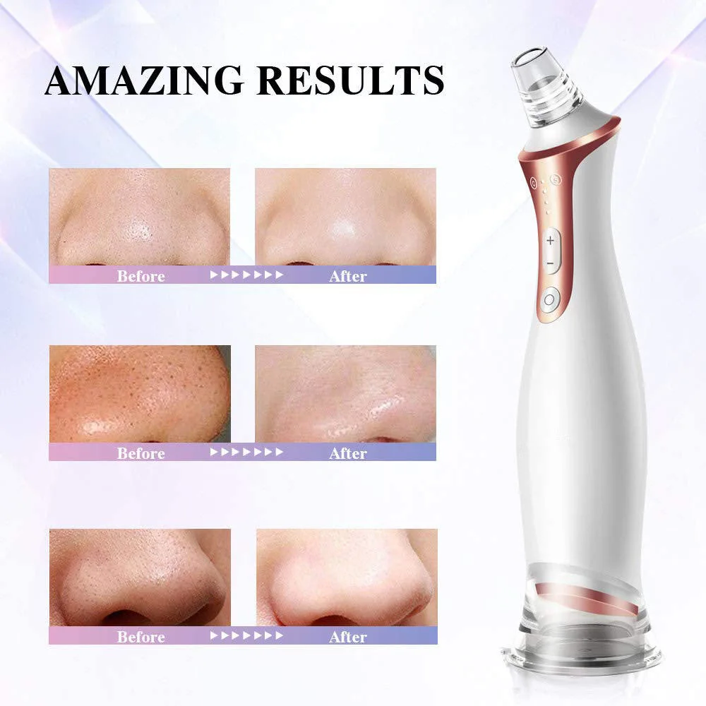 Best-seller Face Kit de dépose de l'acné, de nettoyage facial électrique Blackhead Remover, Aspirateur de pores