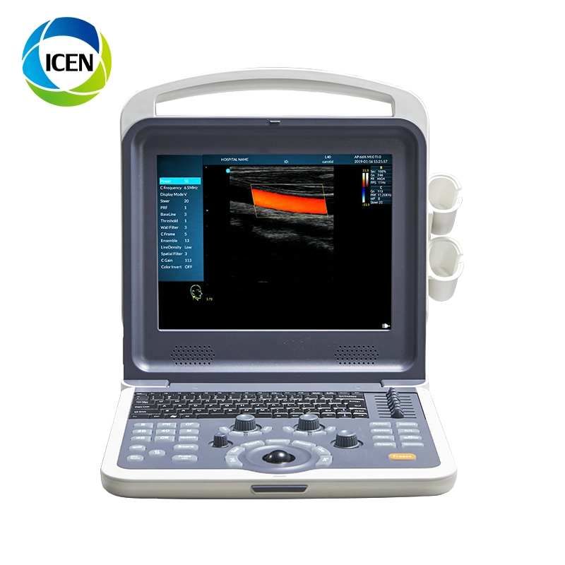 IN-AK0 iPhone Probe 3D 4D Color Doppler Ultrasound Cavitation Machine