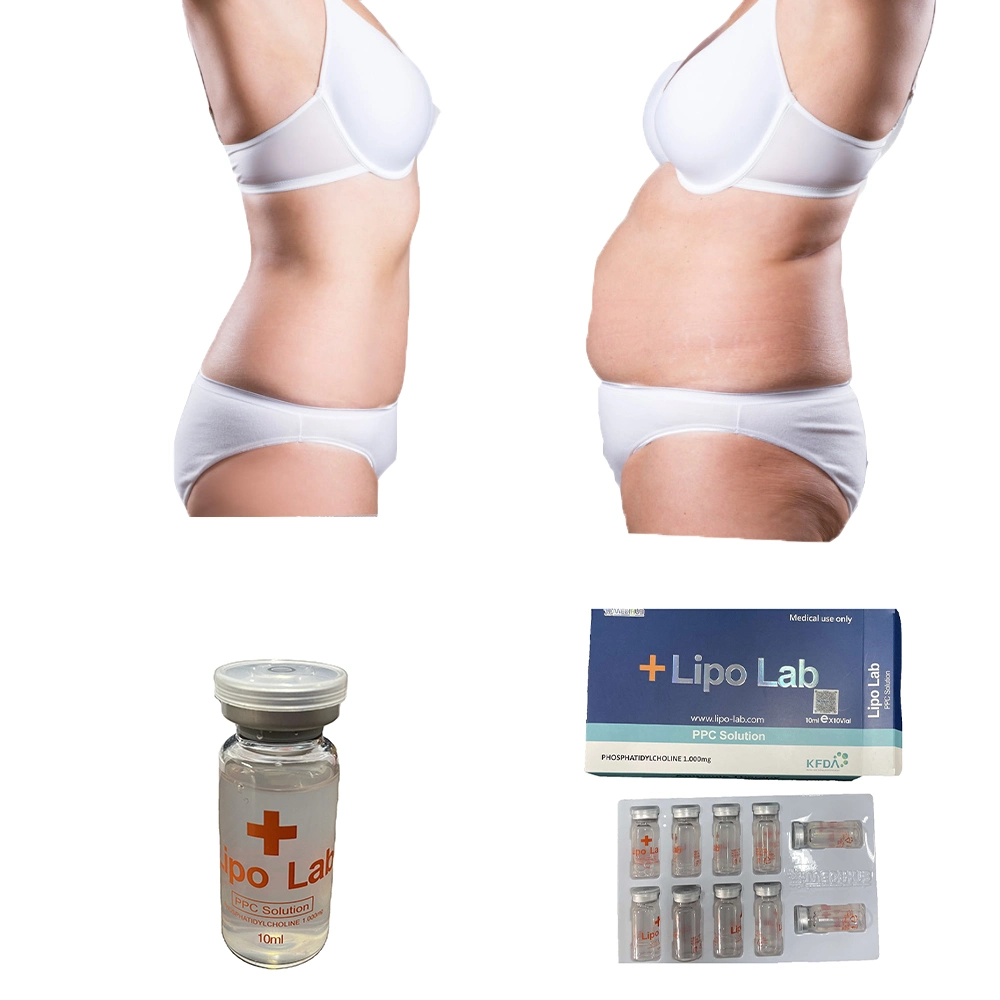 الجملة كوريا 10زجاجات/صندوق سائل Lipo Lab محلول PPC Meso V يتلاشى الدهون في خط الحقن المضلعات في الأديدية