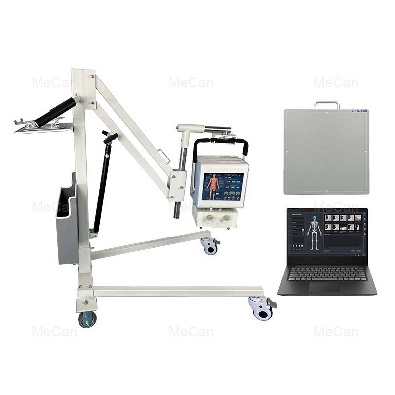 Hot Selling Mobile X-ray Machine