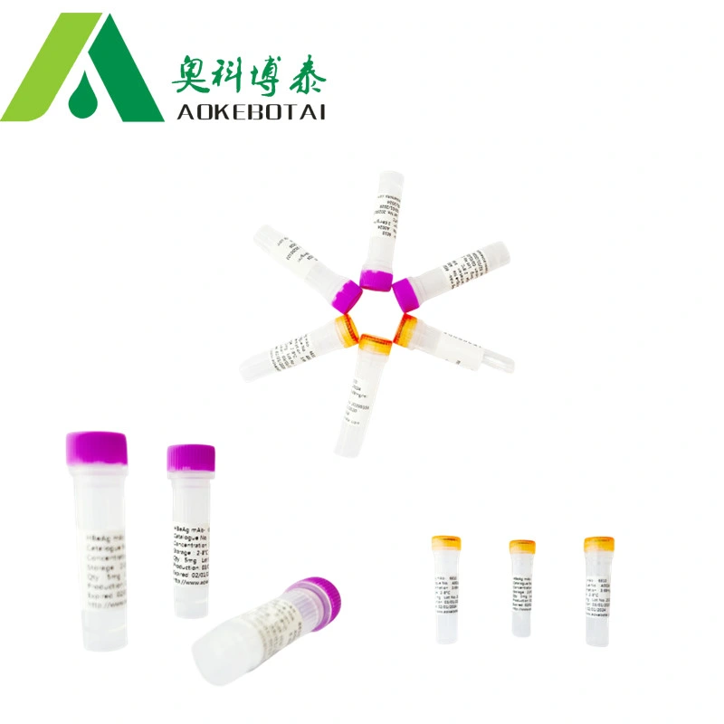 Fabricante de la prueba de suministro marcador Cyfra21-1 antígeno con alta calidad y. precio competitivo