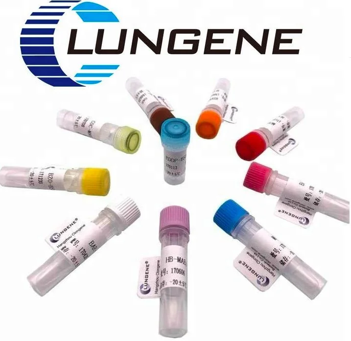 Diagnostic Reagent Mouse Anti-Prostate Specific Antigen Monoclonal Antibody for Ivd Manufacturers