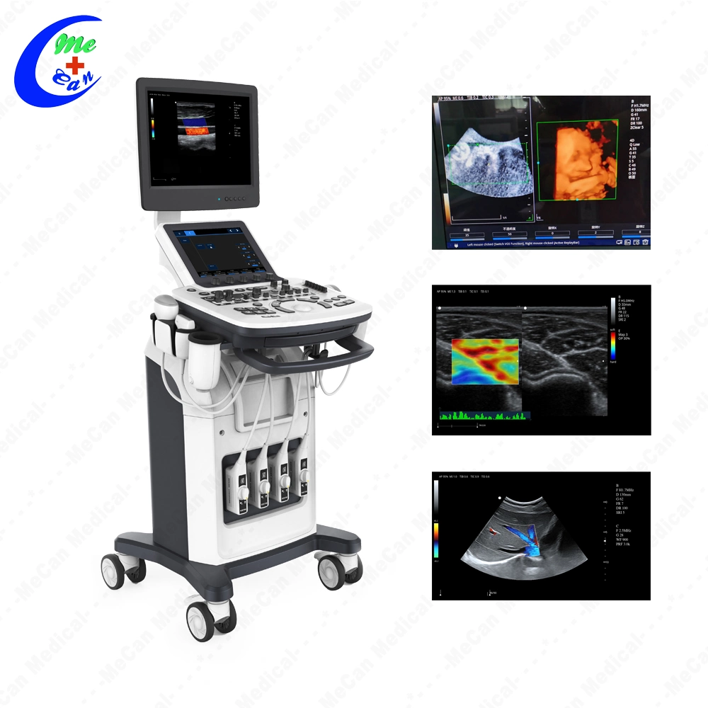 Trolley Ecografo 3D 4D Color Doppler Ultrasound Machine, Digital Cardiac Ultrasound Scanner