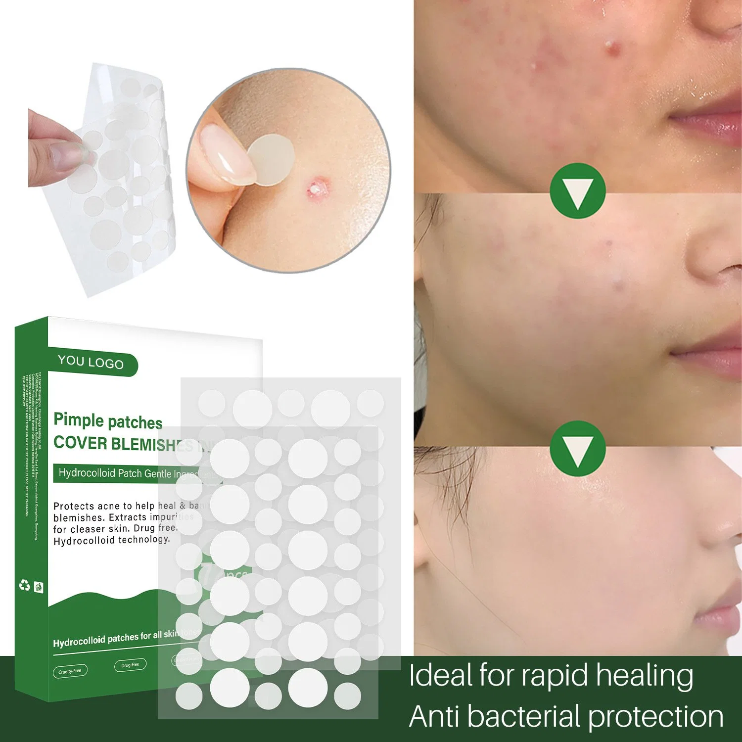 Beauty Cosmetics Skin Care Covering Zits and Blemishes Breakouts Spot Treatment Facial Stickers