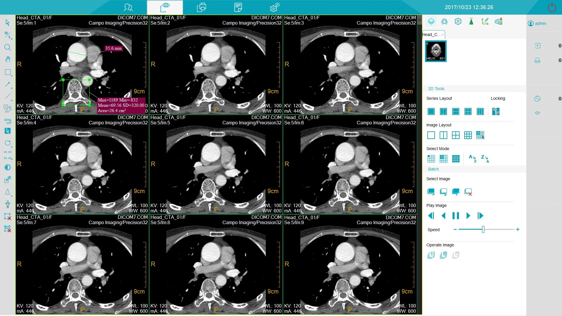 Fabricante CT Scanner MRI Pet 4 16 32 64 128 Equipo médico de Tomografía computarizada por cortes para uso hospitalario