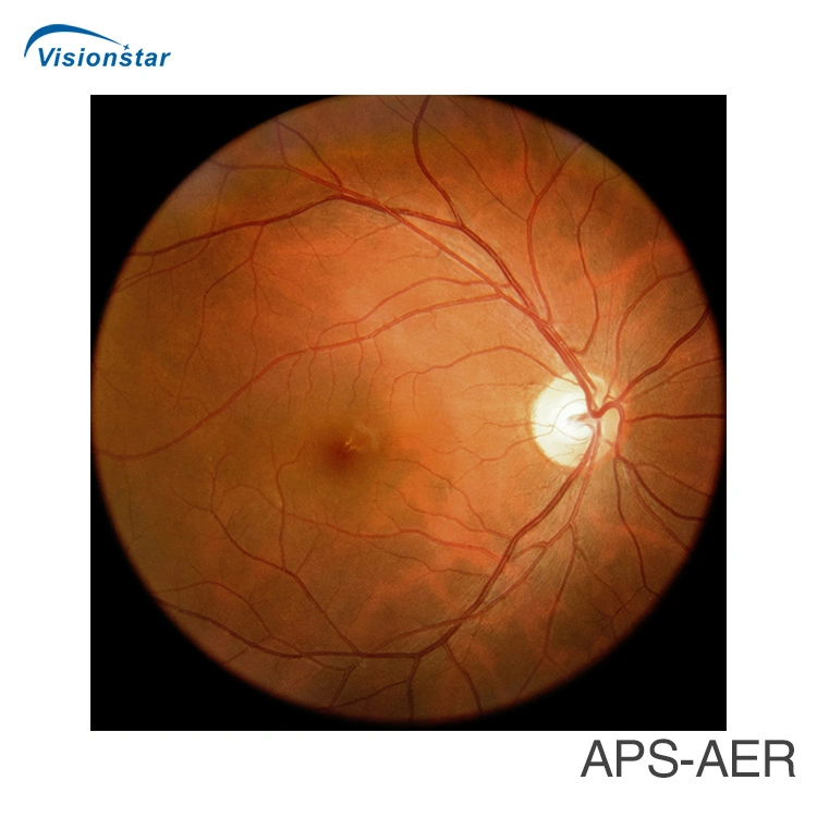 with Ce FDA Approved Fundus Camera