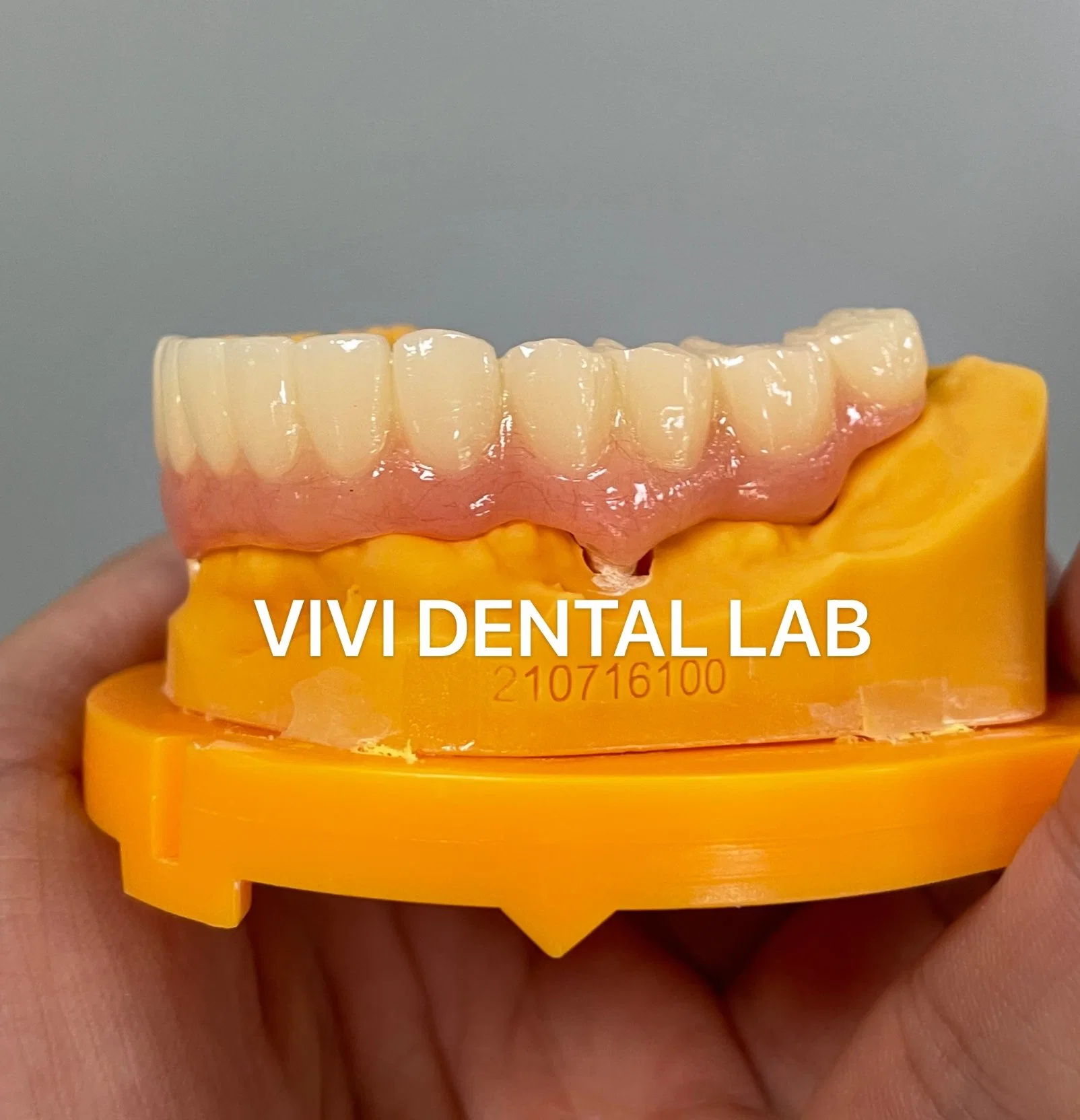 Temporary Crown - China Dental Lab Dental Crown in Good Quality and Good Esthetics