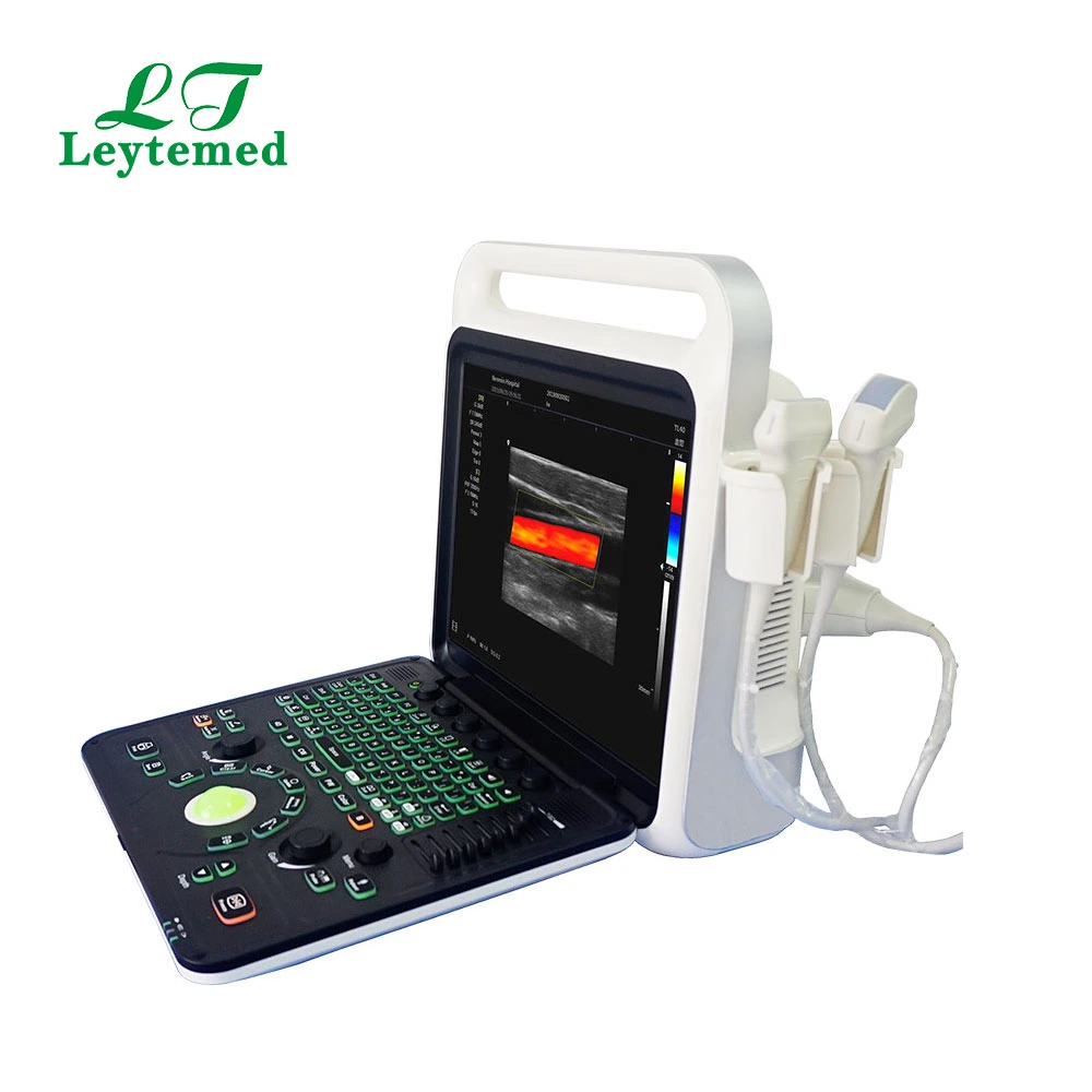 Ltub64 Medical Gynecology Obstetric Full-Digital USB Color Doppler Ultrasound USG