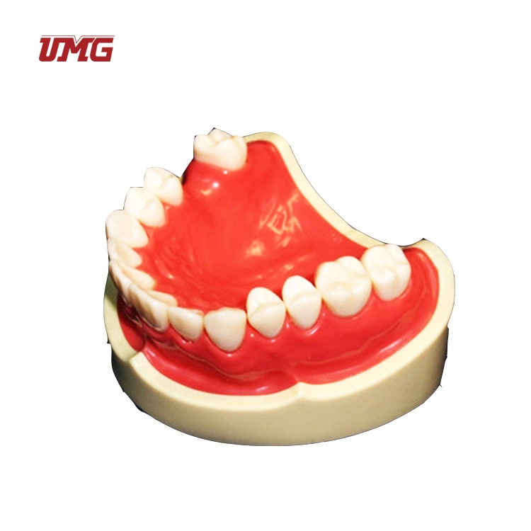 New Dental Educational Model Teeth Missing Model