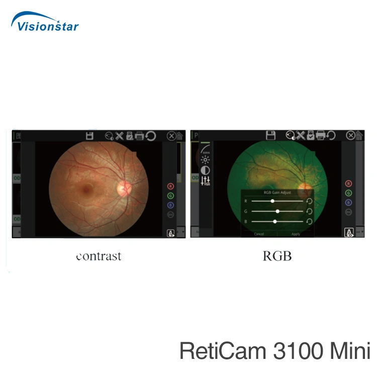 Réticule 3100 (modèle B) Fundus Fluorescent Angiography Fundus Camera &amp; FFA