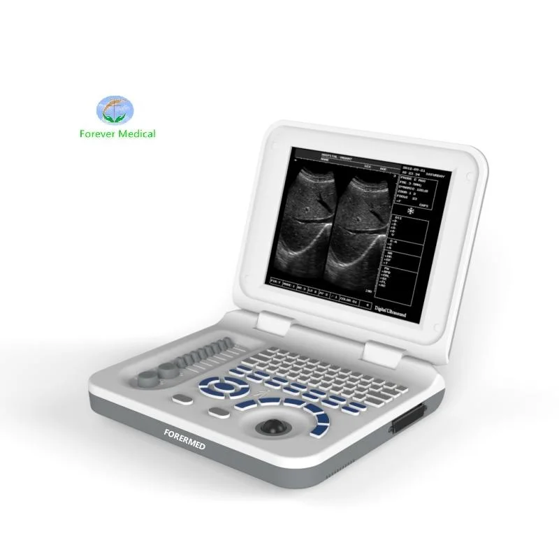 China Supply 10.4 Inch Screen Medical Ultrasound Machine Portable Ultrasound Scanner