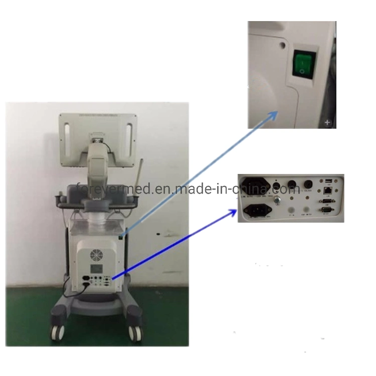 Hot Sales diagnostic Ultrasound scanner vétérinaire échographe