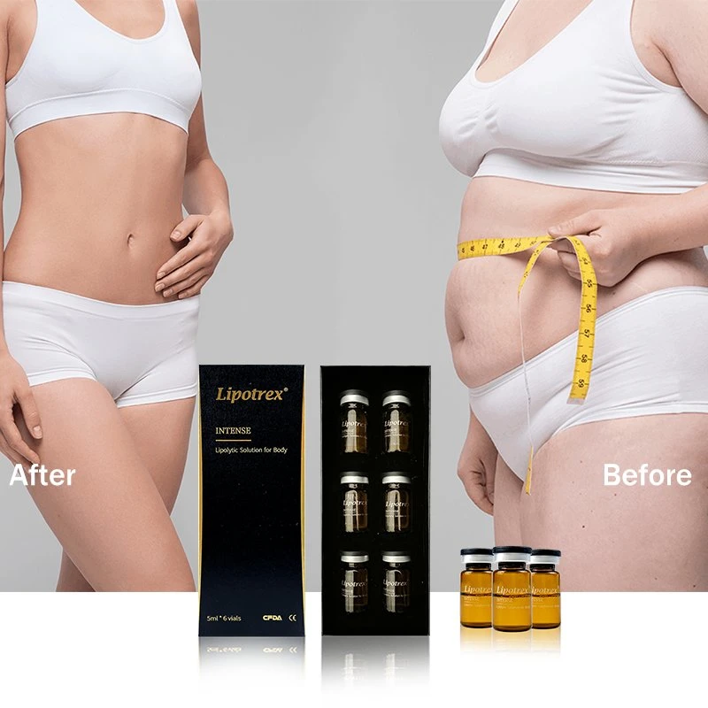 Lipotrex Lipo Lab mésothérapie sous étiquette privée la perte de poids de la lipolyse Dissolver gras d'injection de solution