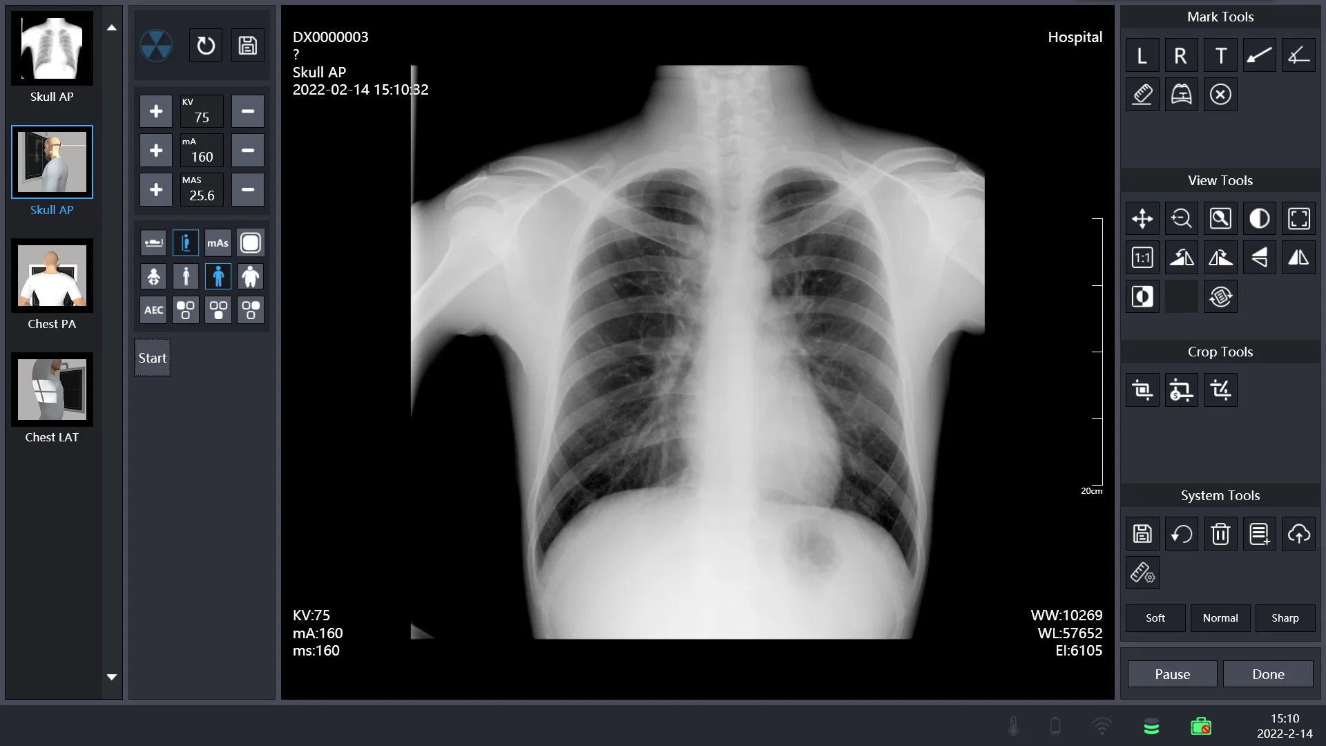 Venda a quente dr portátil de segurança detector de painel plano do sistema de raios x