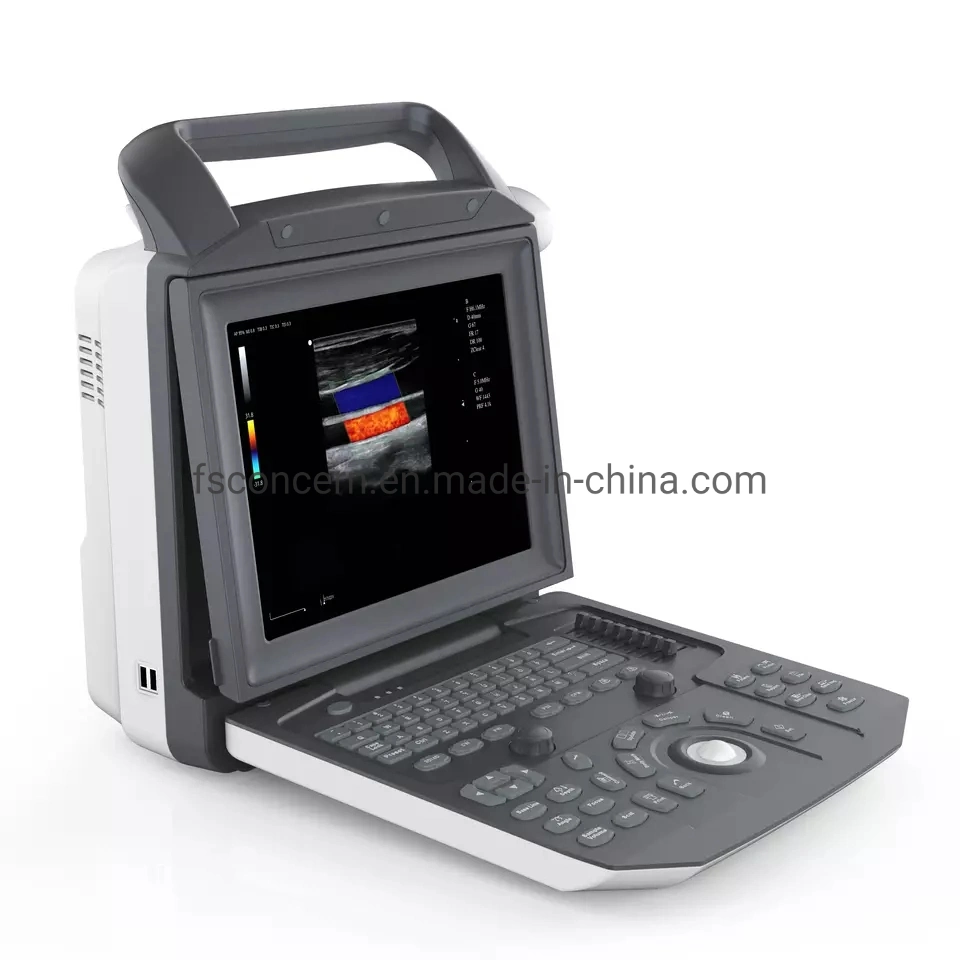Medical Animal Pregnancy Scanner Portable Quality Color Veterinary Ultrasound System
