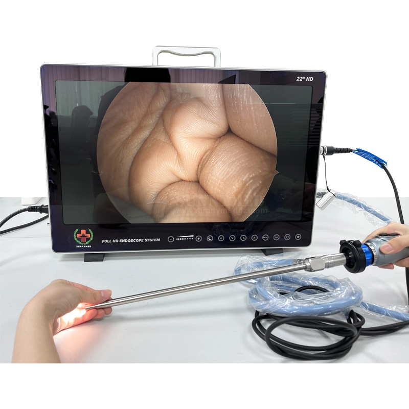 Sy-PS050 Full HD Integrated Imaging System Endoscope Ent Endoscopy Endoscope Camera