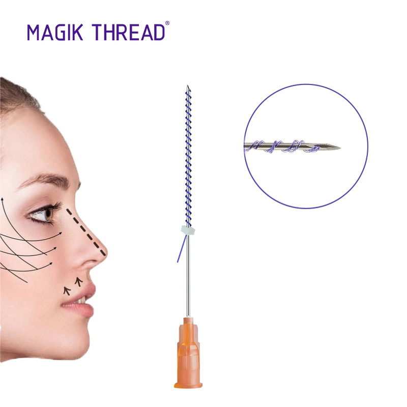 Magik Thread Medical Products Tornado Screw Pdo Thread for Face Thread Lift