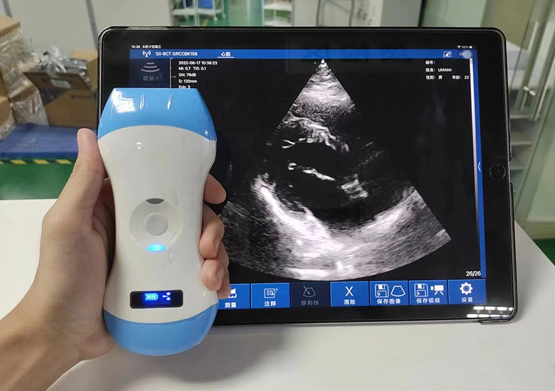 128 Elements Mini Wireless Ultrasound Scanner Bluetooth Ultrasound Probe