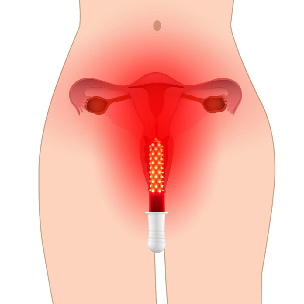 Profession de la fabrication de gynécologie de l'équipement médical pour les femmes les soins personnels