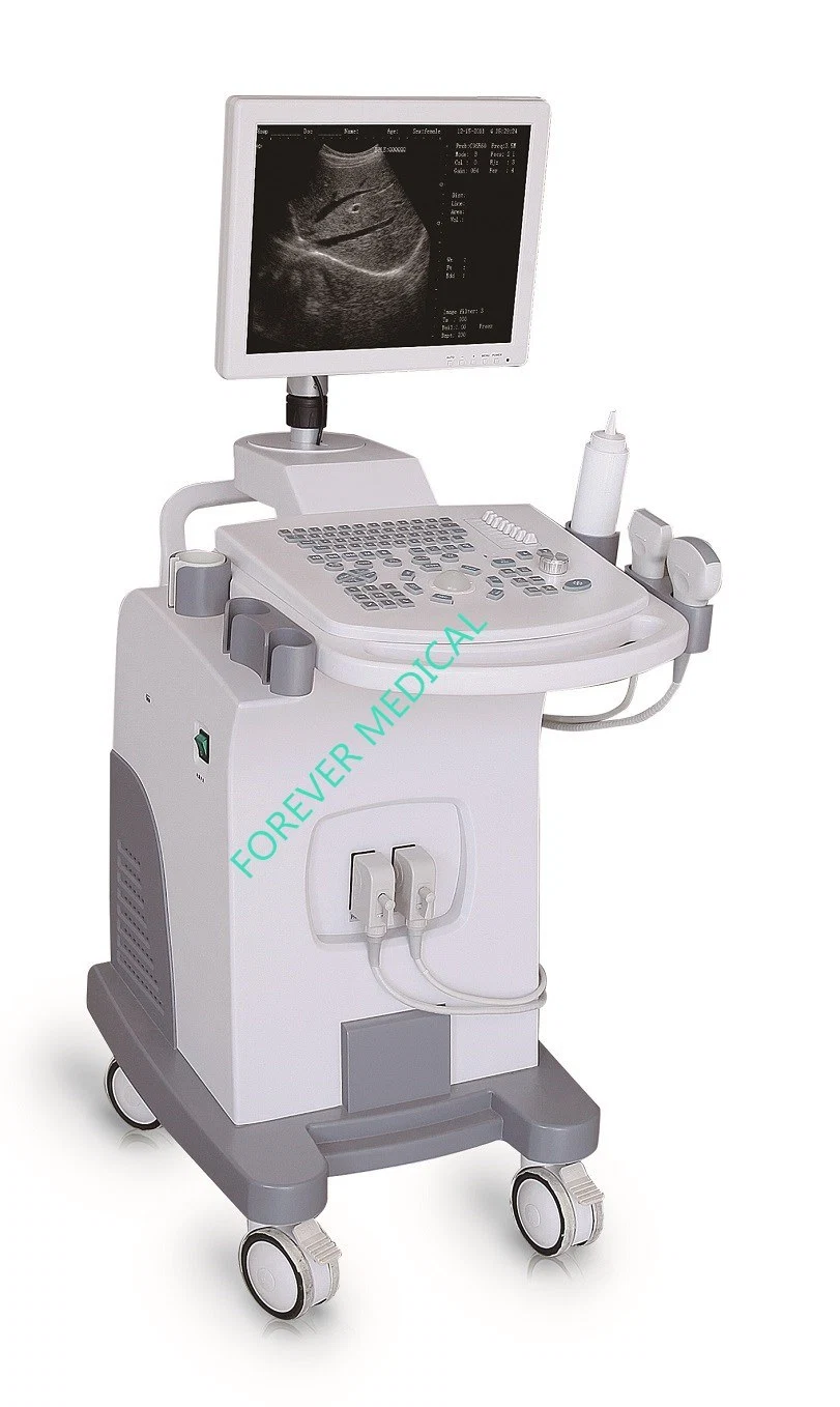 2018 New Product Color Doppler Anesthesia Ultrasound Scanner