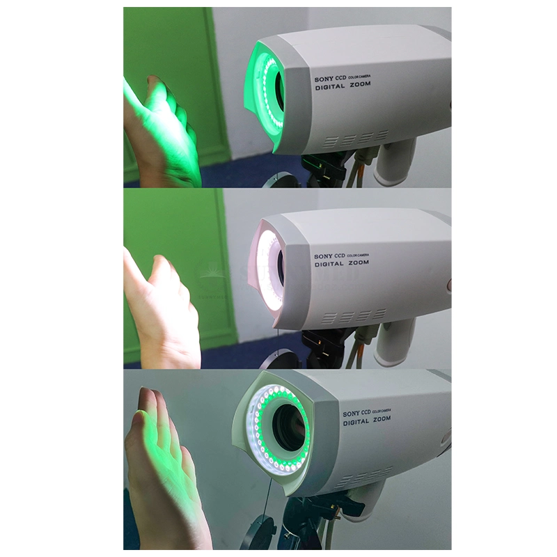 Sy-F005 LED Cold Light System CCD Camera Handheld Video Colposcope Price