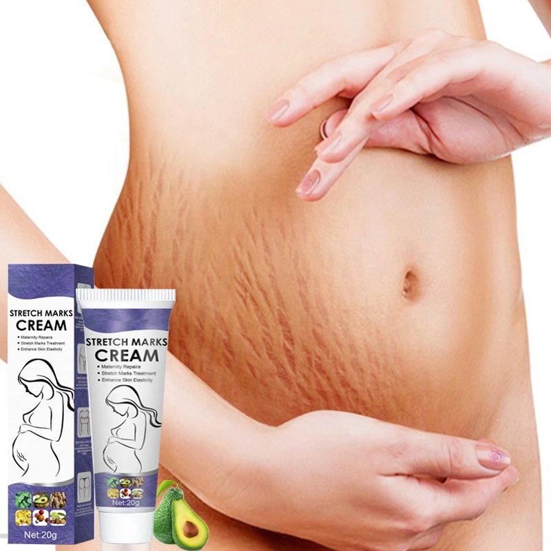 Cuidados com o corpo de cicatriz de acne profunda Anti Esticar Mark Extracção da nata