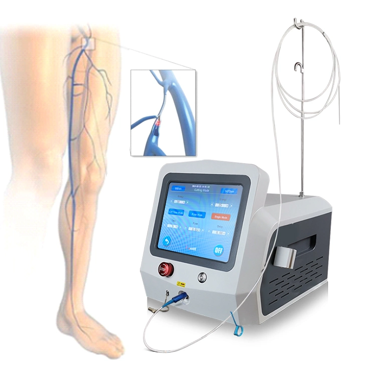 Máquina de láser endovascular de vena varicosa de pierna 1470