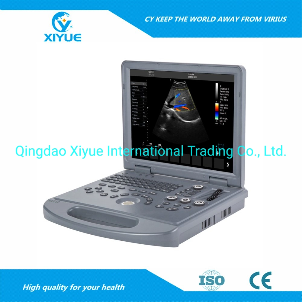 Full Digital Color Doppler Ultrasound Diagnosis System/ Laptop Portable Handheld Ultrasound