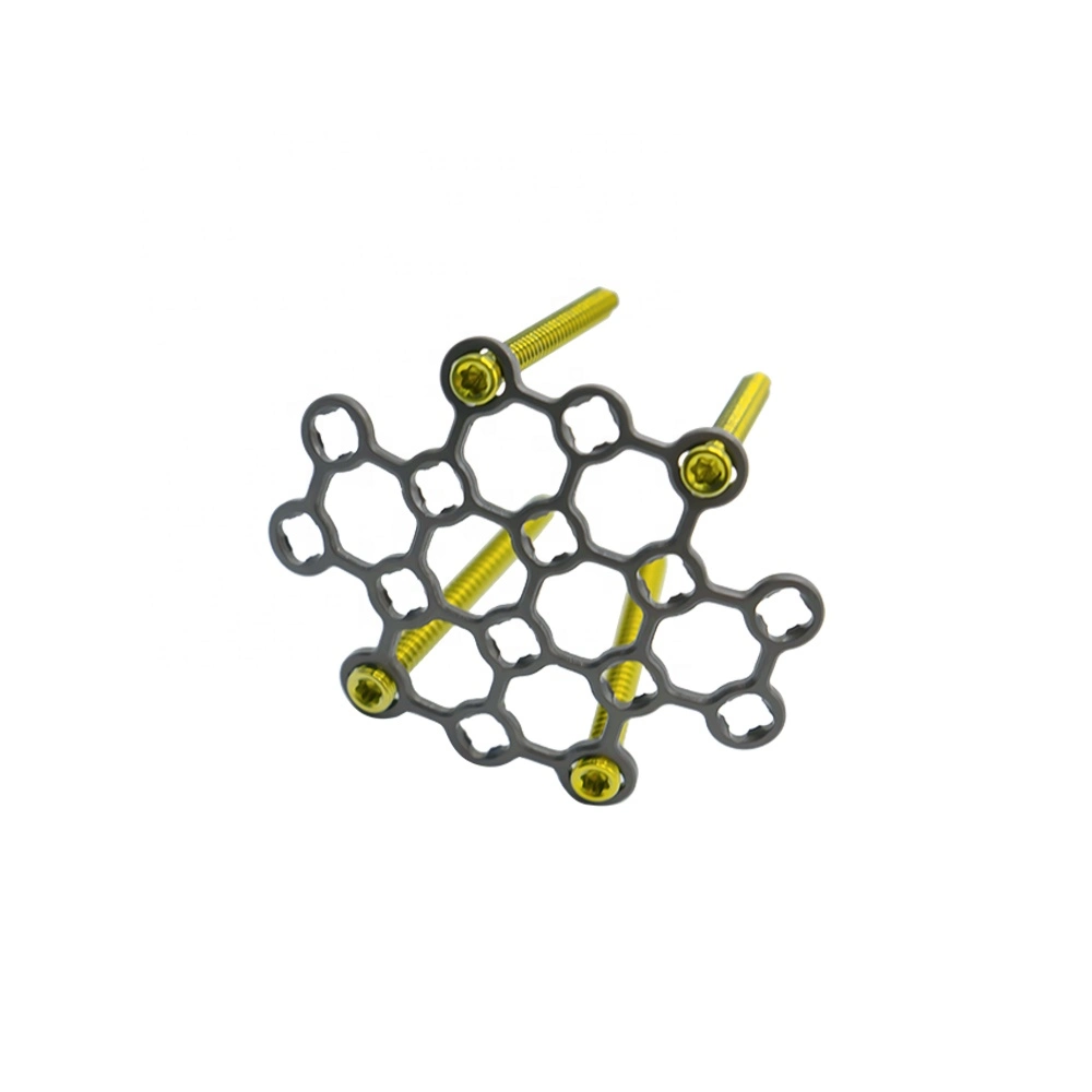 Cirurgia plástica implantes Maxilofaciais placa de crânio implante ortopédico personalizável