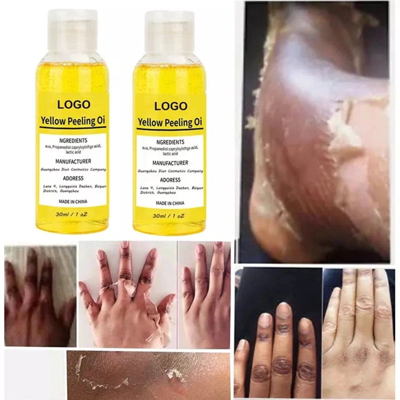 Cuerpo manos Limpieza de la piel exfoliante blanqueamiento extra fuerte blanqueamiento oscuro Piel etiqueta privada aceite de piel amarillo peeling